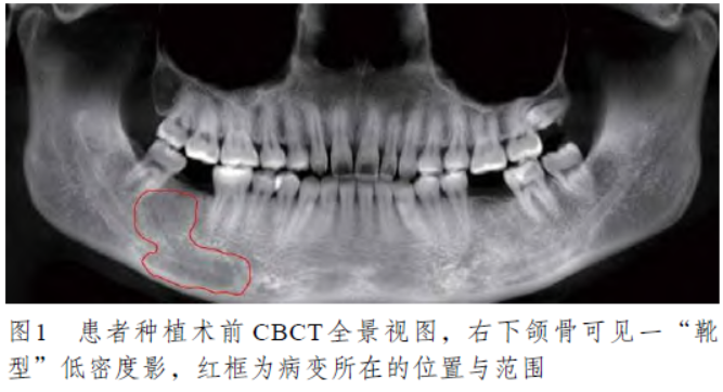 颞下颌与广东省口腔健康研究